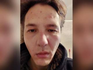 На алматинского журналиста напали в подъезде