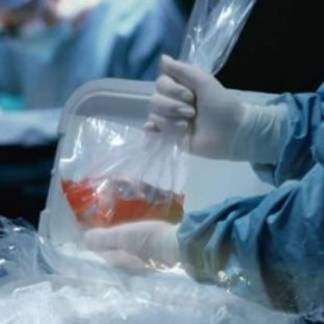 Около трех с половиной тысяч казахстанцев нуждаются в пересадке органов