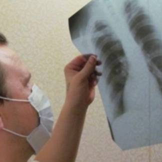 За 24 года в Казахстане снизилась заболеваемость туберкулезом на 9%